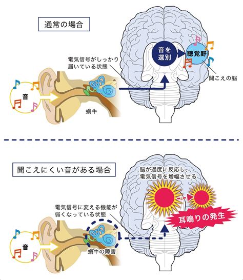 耳鳴時辰